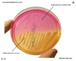 staphylococci on mannitol salt agar, s.aureus mannitol positive colonies